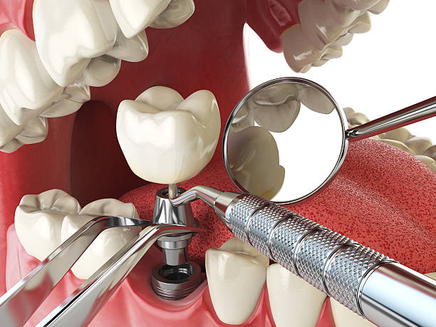 Best Tooth Pain Emergency Relief  in Westvle, IL