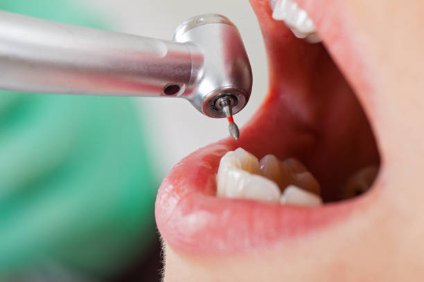 Best Urgent Tooth Repair  in Westvle, IL